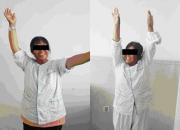 微創(chuàng)先行！朝陽(yáng)市中心醫(yī)院成功開展首例肩關(guān)節(jié)鏡手術(shù)